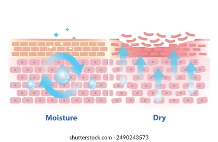 The mechanism of moisture and dry skin layer vector illustration. Comparison of skin hold oil, preserved in a good balance and dry skin lacking water, oil and peeling off in the uppermost layer.