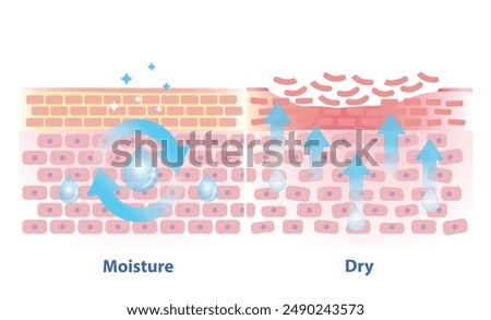 The mechanism of moisture and dry skin layer vector illustration. Comparison of skin hold oil, preserved in a good balance and dry skin lacking water, oil and peeling off in the uppermost layer.