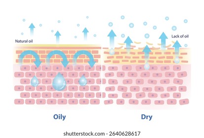 The mechanism of oily and dry skin vector illustration. Comparison of natural oil on skin layer acts as an occlusive, less transepidermal water loss. And lack of oil on skin causes more TEWL.
