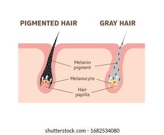 Mechanism of pigmented hair and gray hair / comparison vector illustration 