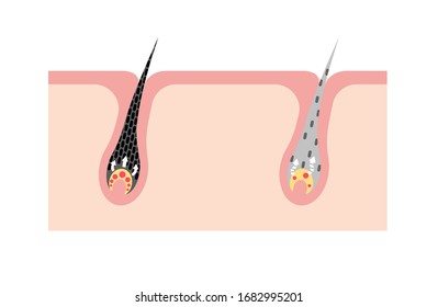 Mechanism of pigmented hair and gray hair / comparison vector illustration / no text