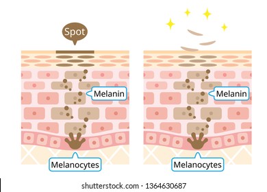 mechanism of skin cell turnover illustration. Melanin and melanocytes in human skin layer. beauty and skin care concept
