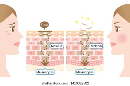 mechanism of skin cell turnover illustration. Melanin and melanocytes in human skin layer with woman face. beauty and skin care concept