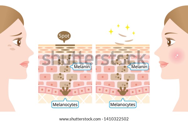 mechanism of skin cell turnover illustration. Melanin and melanocytes