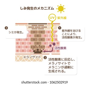 mechanism of skin pigmentation / skin spot illustration. translation: UV,malanin,melanocyte,reactive oxygen/1. by exposure of UV, reactive oxygen is generated/2.melanin is excessively produced by...