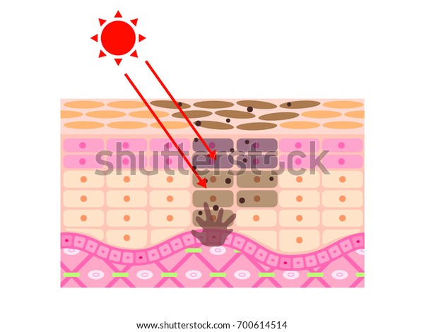 Mechanism Skin Stain Illustration Stock Vector (royalty Free) 700614514 