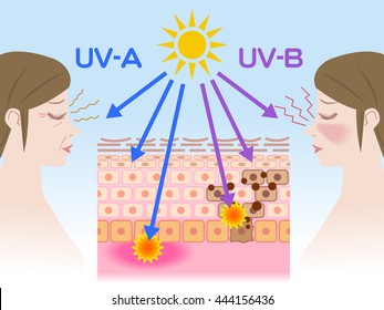 Mechanism Of Sunburn And Aging Of The Skin