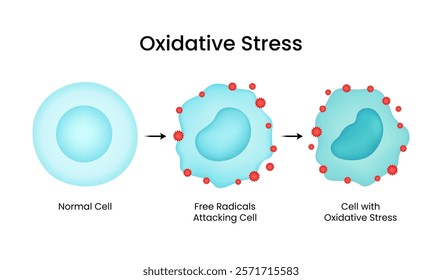 Mechanisms of Oxidative Stress Inflammation