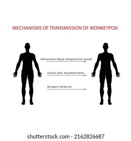 Mechanisms and ways of transmission of monkeypox.Monkeypox virus zoonotic viral disease that can infect human, nonhuman primates. Monkey pox. Vector illustration