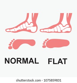 Medial foot anatomy Human foot with bones