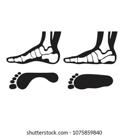 Medial foot anatomy Human foot with bones