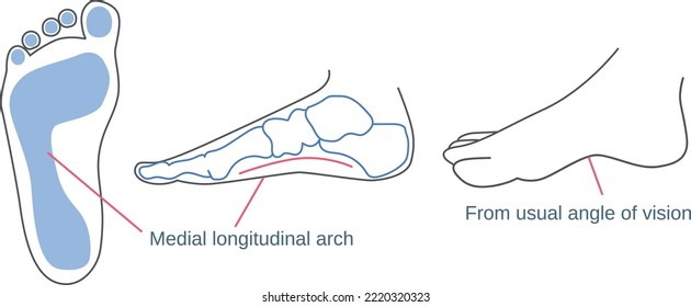 Medial longitudinal artery explanatory drawing