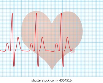 Medical abstract background showing an ecg heart beat over a technical grid