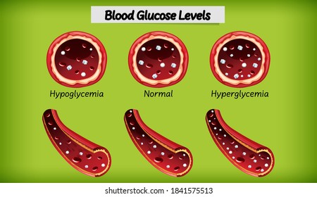 1,855 Cartoon Blood Sugar Images, Stock Photos & Vectors | Shutterstock