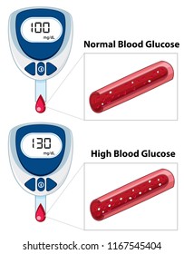 Medical Blood Glucose Measurement Illustration Stock Vector (Royalty ...