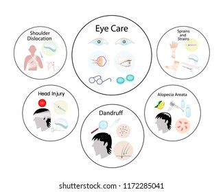 Medical Concept, Illustration of Sprains and Strains, Recurrent Dislocation of Shoulder, Head Injury, Eye Care, Alopecia Areata and Dandruff or Flaky Scalp with Medical Treatment.