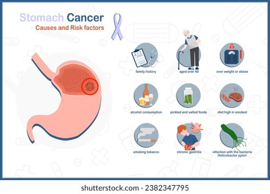 Medical Concepts of causes and risk factors of stomach cancer.Obesity, over 60 years of age, smoking,eating pickled and salty foods including smoked foods, infection with bacteria Helicobactor pylori.