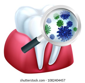 A medical dental illustration of bacteria on a tooth being magnified