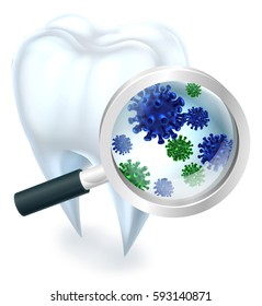 A medical dental illustration of a tooth covered in bacteria viewed through a magnifying glass