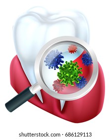 A medical dental illustration of a tooth and gum with bacteria or micro organisms viewed through a magnifying glass