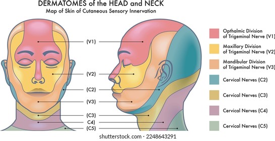 Medical diagram of Dermatomes of the head and neck.