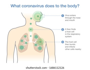 Medical Diagram For Explain About What Coronavirus Does To The Body. Illustration About Covid-19 Disease When Virus Into Respiratory System.