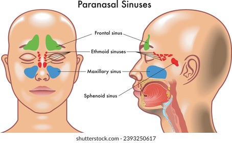 Medical diagram of  Paranasal Sinuses in the human head.