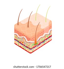 Diagrama médico de la estructura de la sección transversal interna de la piel humana. Anatomía del trastorno de Vitiligo, enfermedad de la piel. Concepto infográfico vectorial de existencias aislado en fondo blanco