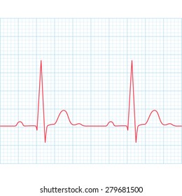 Medical electrocardiogram - ECG on grid paper, graph of heart rhythm, 2d illustration, vector, eps 8