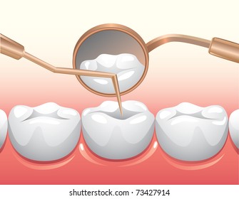 Medical Exam of teeth