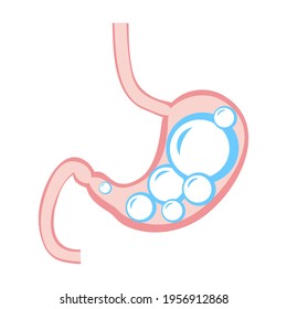 Medical Illustration Of Abdominal Bloated Stomach. Transperant Ball Inside Stomach. Gases In Stomach. Overeating Problem, Diabetic Prevention Banner Design. Hunger Symptom, Belly Disease Background