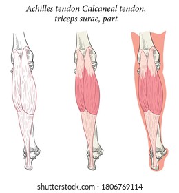 Medical Illustration Bacl View  Of Foot Achilles Tendon Calcaneal Tendon, Triceps Surae, Part. Specialized Images For Medicine, Student Learning, And Sports Science.