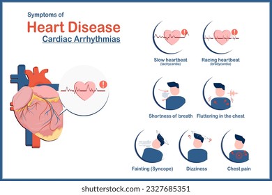 Medical illustration concept, heart disease symptoms caused by irregular heartbeat or cardiac arrhythmias, fatigue, tachycardia, bradycardia, dizziness, chest pain and syncope, flat style.