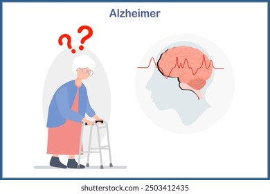 Medical illustration in flat style .Concept of Alzheimer's disease. Elderly woman uses a crutch. There are symptoms of fuzzy memory and forgetfulness, which is a cause of Alzheimer's disease.