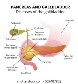 Medical illustration of the internal organs, the pancreas and the duodenum location in the human body, gallbladder disease - gallstones