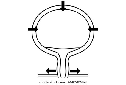 Medical illustration of the normal bladder, how it urinates, and how it urinates, Vector Illustration