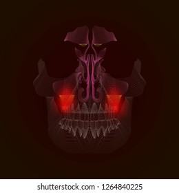 Medical illustration of the points. Odontogenic sinusitis. Inflammation of the maxillary sinuses due to a disease of the roots of the tooth with a point of pain and inflammation. X-ray effect