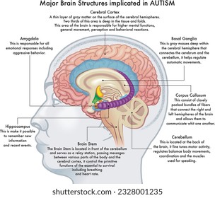Medical illustration showing major brain structures implicated in autism spectrum disorder, with annotations. svg