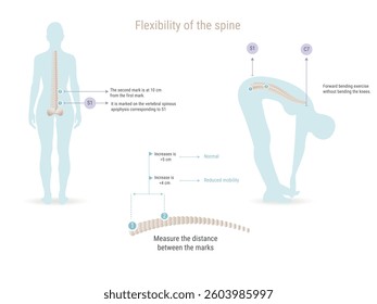 Medical illustration showing spine flexibility measurement during forward bending exercise, indicating normal and reduced mobility