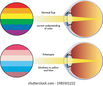 79,450 Colour blind Images, Stock Photos & Vectors | Shutterstock