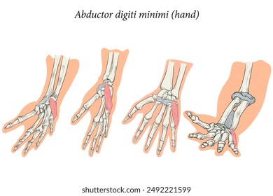 Medical illustration of the superficial muscle of the hand and is associated with the hypothenar (fifth digit) eminence. Specialized images for medicine, student learning, and sports science.