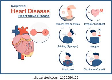 Medical illustration vector concept,symptoms of heart disease caused by heart valve disease.swollen feet or ankles,irregular heartbeat,fatigue,Shortness of breath,fainting or syncope flat style.