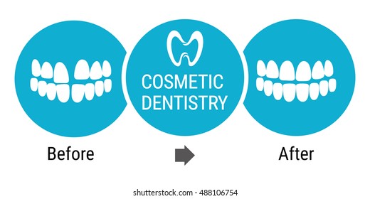 Medical infografics: Dental services. Cosmetic dentist before and after. Dental design over white background vector illustration