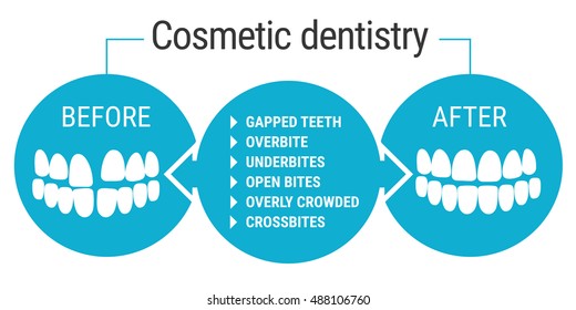 Infografics médicos: Serviços odontológicos. Dentista cosmético antes e depois. Desenho dental sobre ilustração vetorial de fundo branco