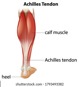 Medical infographic of achilles tendon illustration