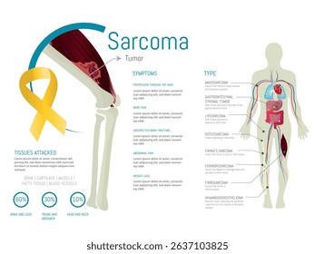 Medical infographic illustrating sarcoma, a rare type of cancer affecting connective tissues like bone and muscle, showing symptoms, types, tissues attacked, and affected body areas