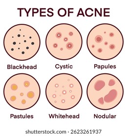 Infográfico médico mostrando diferentes tipos de erupções cutâneas, ajudando a identificar condições dermatológicas, sintomas e tratamentos, útil para médicos, estudantes, educação dermatológica ou guia de saúde