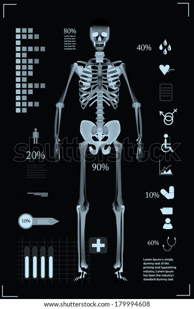 Medical Infographic Template X Ray Style: vector de stock (libre de ...