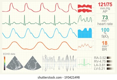 Medical monitor with data set. Possible professional use. Vector illustration