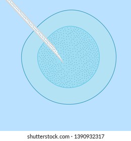 Medical Operation, Syringe Thin Needle Or Laser In Cell Invitro Injection. Medicine Biology, Cell Genetics And Innovation Healthcare Technology, Nuclear Microbiology And Cancer Treatment